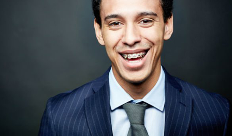 Benefits Of Traditional Braces In Orlando 6 Blog 102