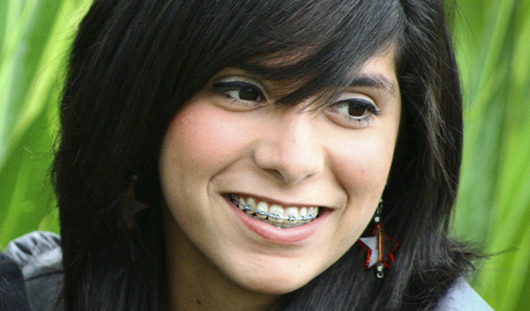Avoiding Post-Braces Stains 3 Blog 123