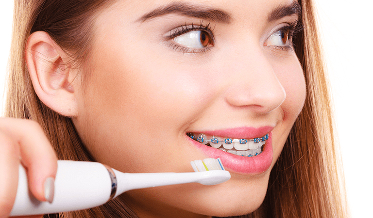 Brushing With Braces 9 Blog 128