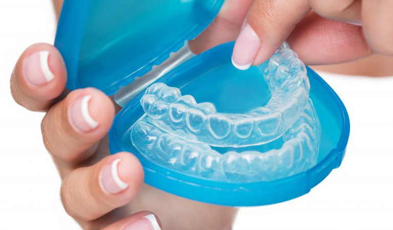 Considering Invisalign In Orlando? Lach Orthodontic Specialists Has You Covered 1 Blog 130