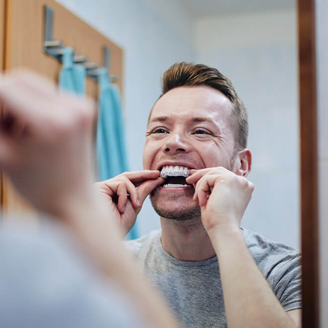 Invisalign® For Adults 4 How does invisalign® treatment work?