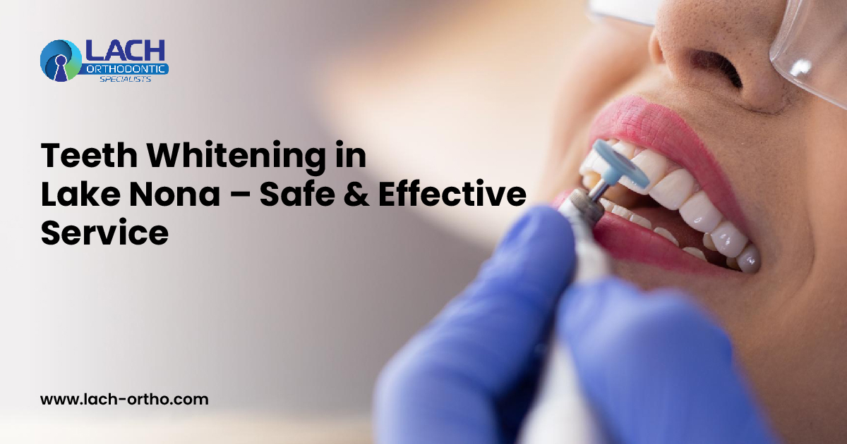 Teeth whitening in lake nona – safe & effective service