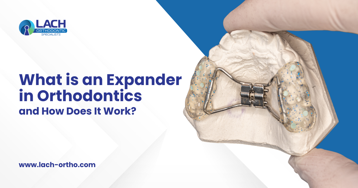 What is an expander in orthodontics