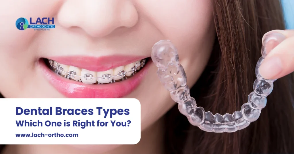 Dental Braces Types Which One is Right for You