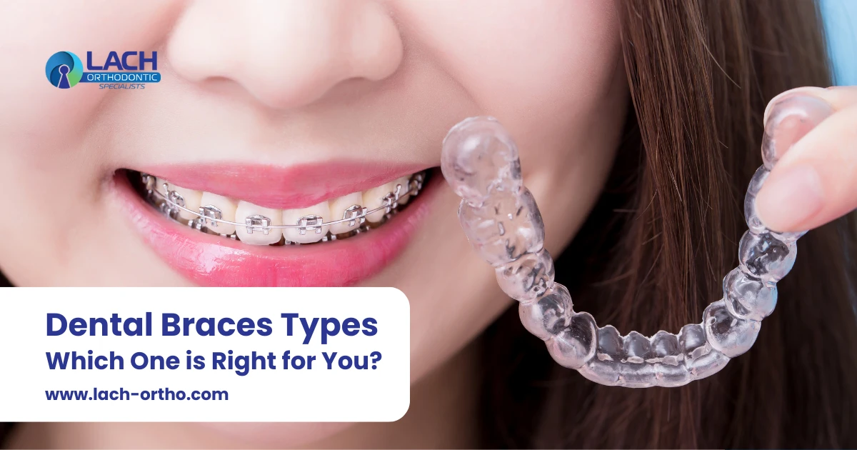 Dental braces types which one is right for you