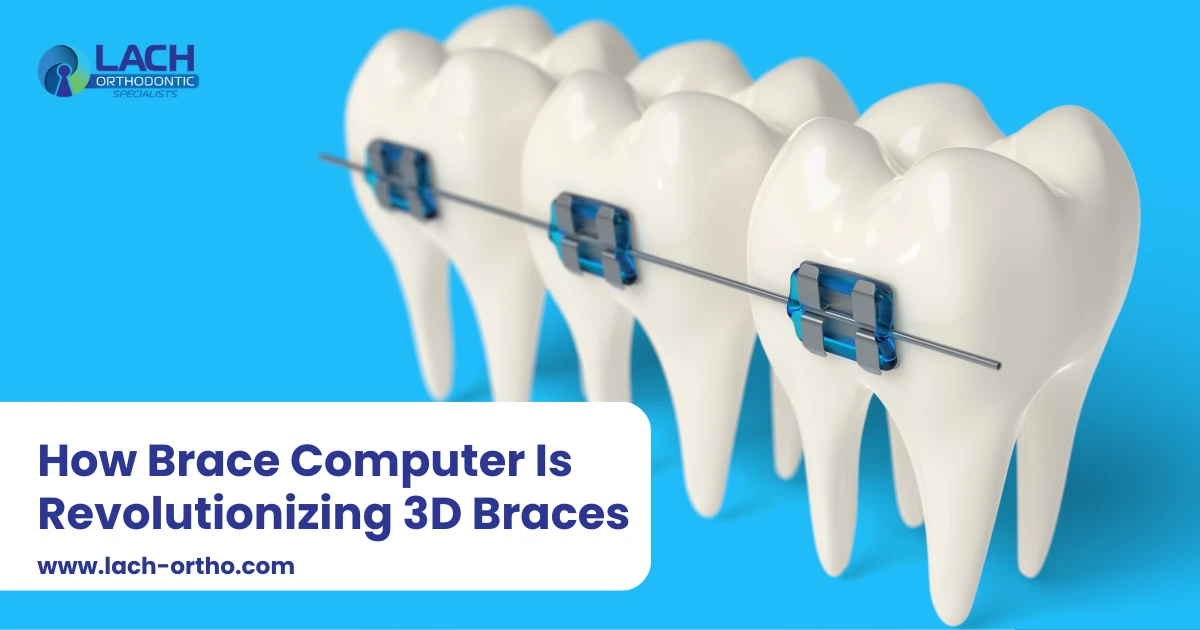 How brace computer is revolutionizing 3d braces